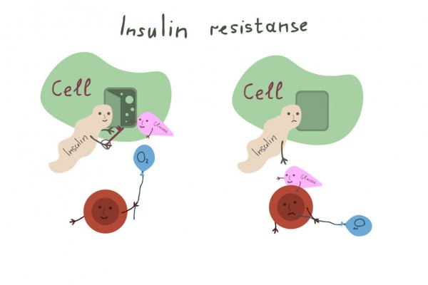 En este momento estás viendo La insulina ¿amiga o enemiga?
